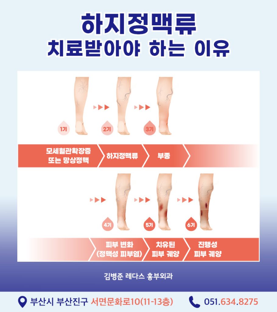가만히 서 있거나 앉아 있을 때는 다리 불편 증상이 나타나지만 가볍게 다리를 움직이면 완화된다.

오전에는 증상이 적다가 오후, 저녁마다 심해진다.