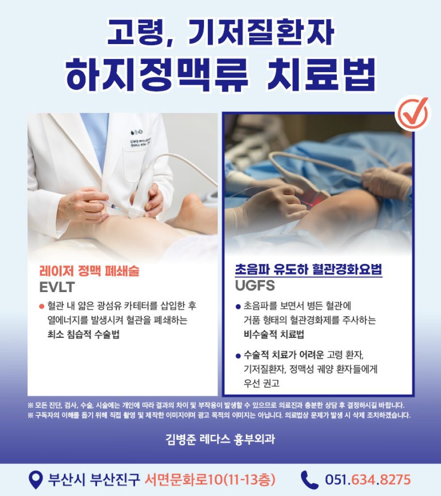 마취나 절개가 필요하지 않아 외래에서도 가능한 치료법으로 수술적 치료가 어려운 고령 환자, 기저질환자, 정맥성 궤양 환자들에게 우선적으로 권고되는 치료법입니다.