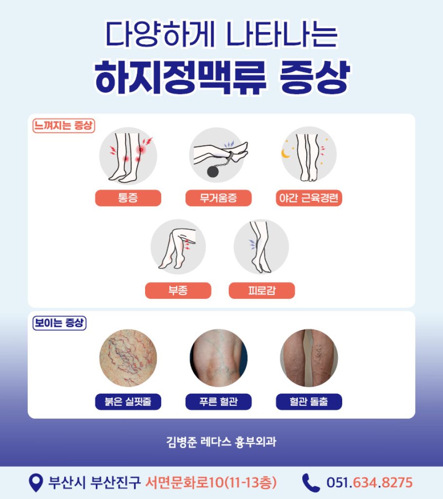 다리통증을 근골격계 질환으로 오인할 수 있는 하지정맥류 증상