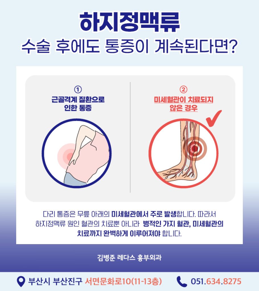 하지정맥류수술 후에도 아프다면? 이런 상황에서 고려해야 할 원인과 치료 방법에 대해 자세히 알아보겠습니다. 하지정맥류 수술 후 가벼워졌던 다리가몇 년 후 다시 아프다면 재발을 의심해 보셔야 합니다