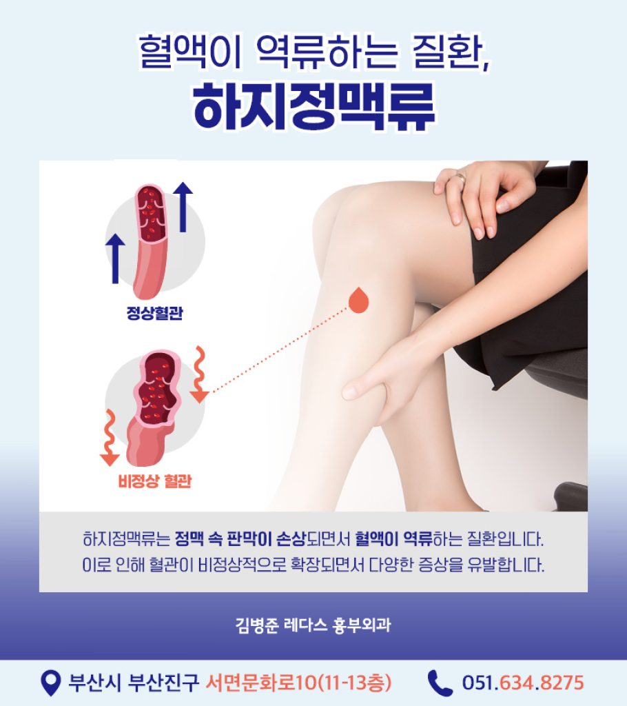 잠복성하지정맥류 는 혈관 돌출이나 붉은 실핏줄, 푸른 혈관 등 눈에 보이는 뚜렷한 증상 없이 나타나는 것을 말합니다. 치료하지 않으면 증상이 악화할 수 있으며 방치할 경우 합병증으로 이어질 수 있습니다.