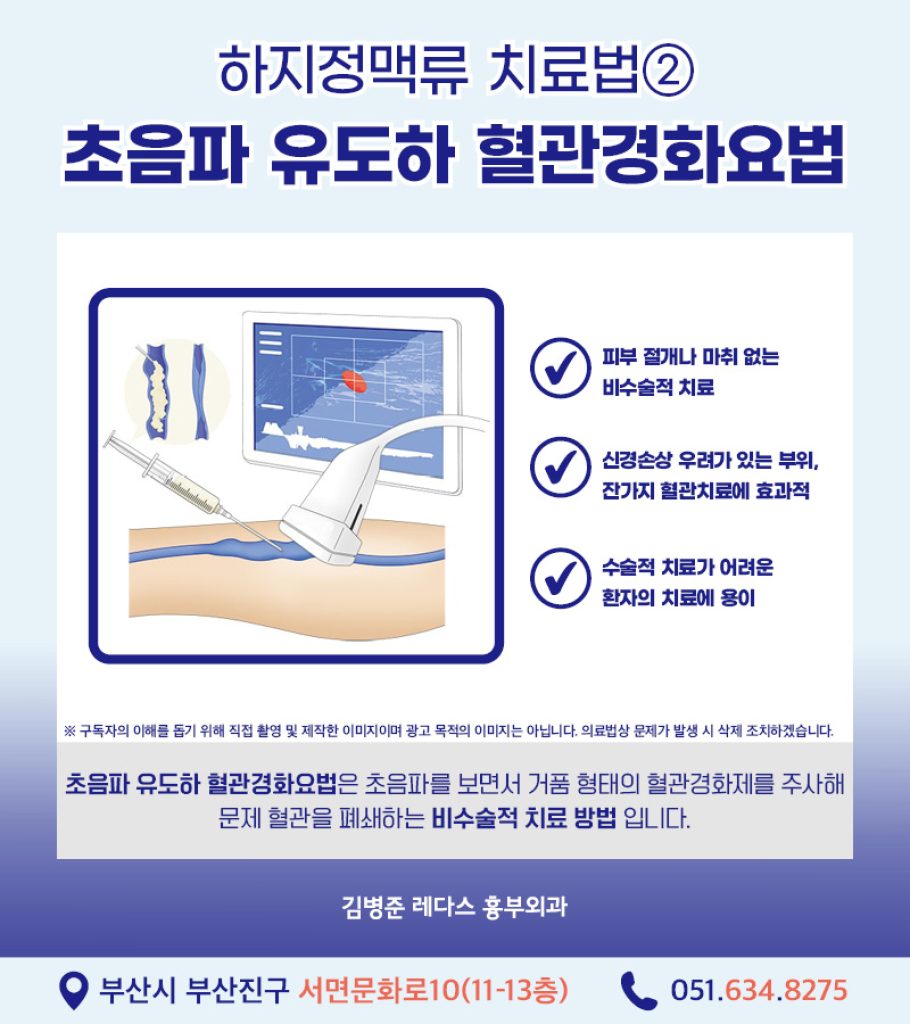혈관 돌출은 하지정맥류 증상 중 하나이므로, 눈에 보이는 혈관 돌출이 없더라도 다리 무거움, 피로감, 통증, 부종, 야간 근육경련 등의 증상이 있다면 하지정맥류를 의심해볼 필요가 있습니다.