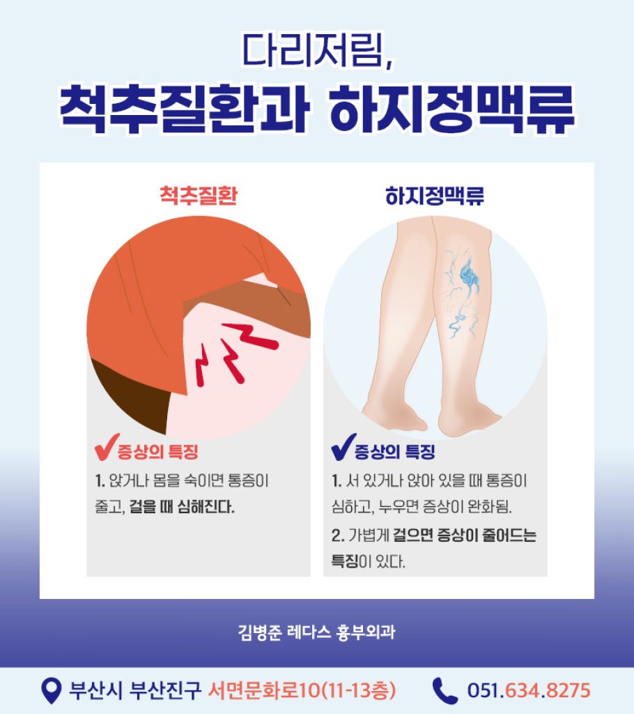 다리저림 하지정맥류의 대표적인 증상으로 울퉁불퉁하게 튀어나온 혈관을 떠올리는 경우가 많습니다. 