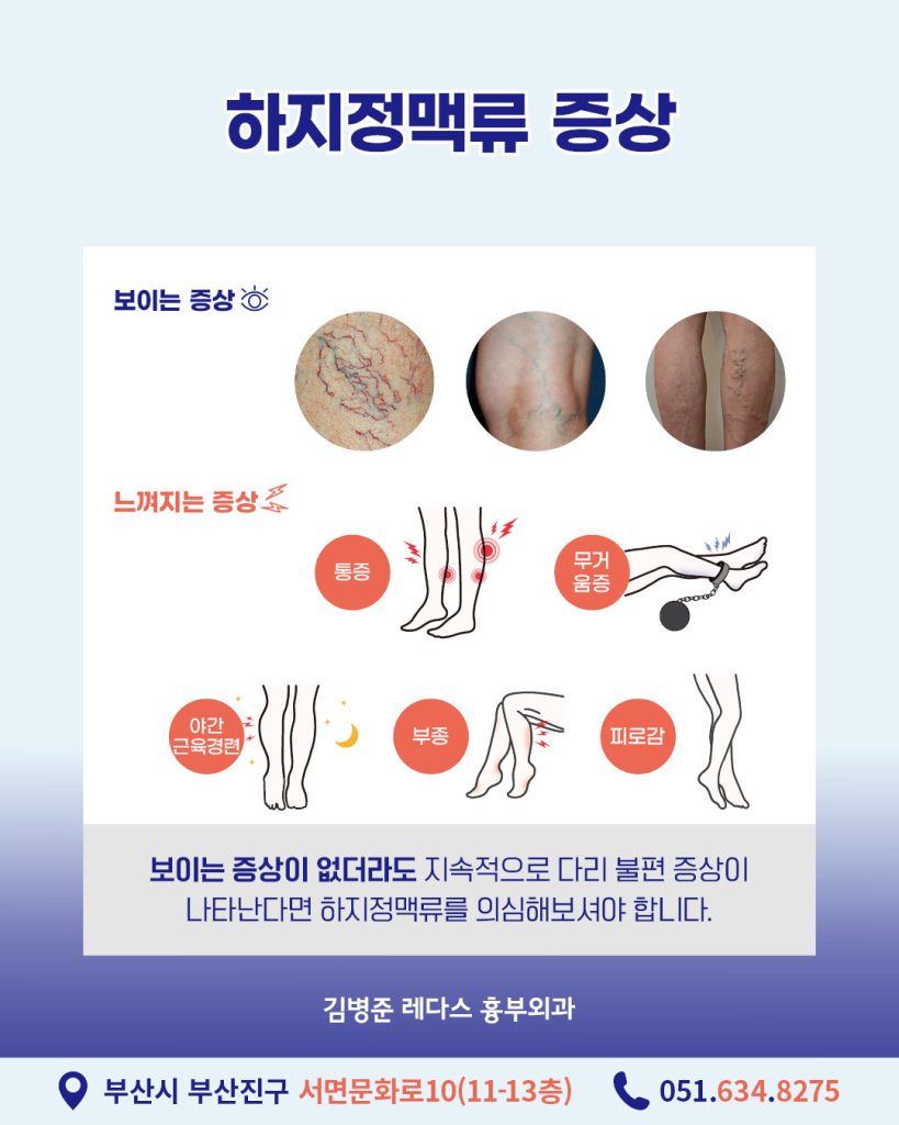잠복성하지정맥류 가장 잘 알려진 증상은 다리에 구불구불하게 튀어나온 혈관의 돌출입니다. 하지만 하지정맥류 환자 중 혈관 돌출을 경험한 환자는 절반도 되지 않는데요. 