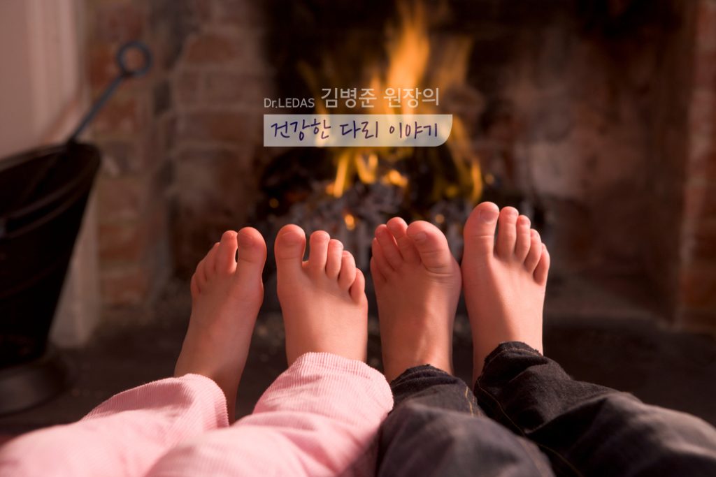 하지정맥류 가족력