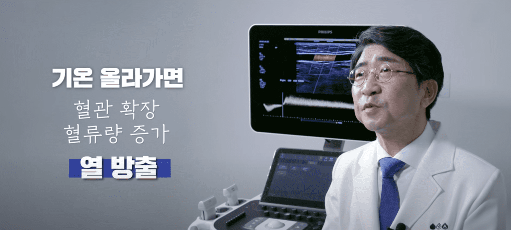 여름 하지정맥류 기온 올라가면 혈관 확장 열 방출