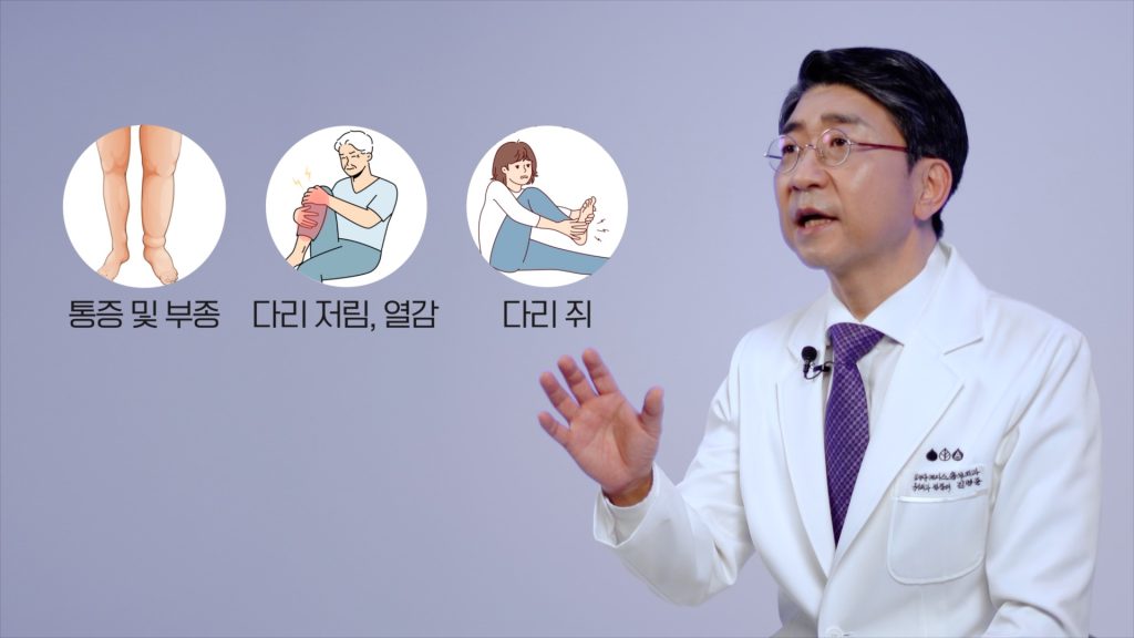 다리통증 부종 다리저림 열감 다리 쥐 는 대표적인 하지정맥류 증상입니다