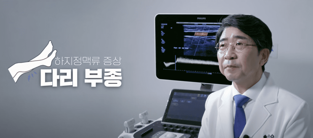 하지정맥류 증상 다리 부종