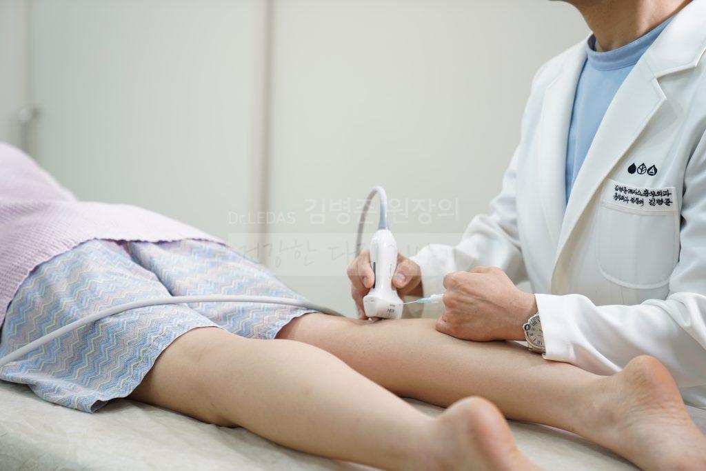 하지정맥류 UGFS