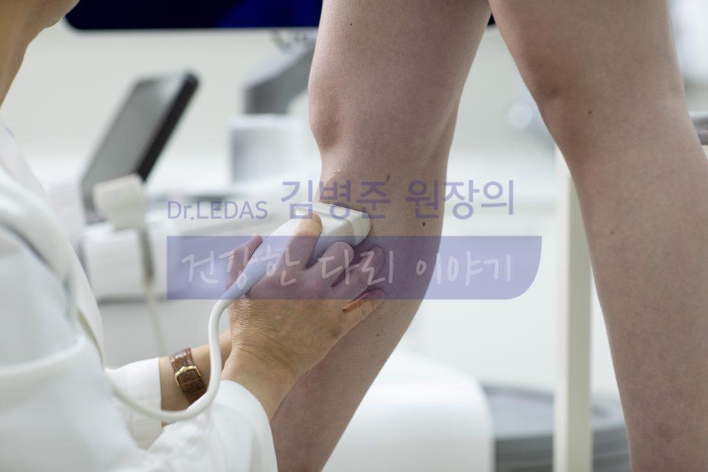 혈관 초음파 검사
