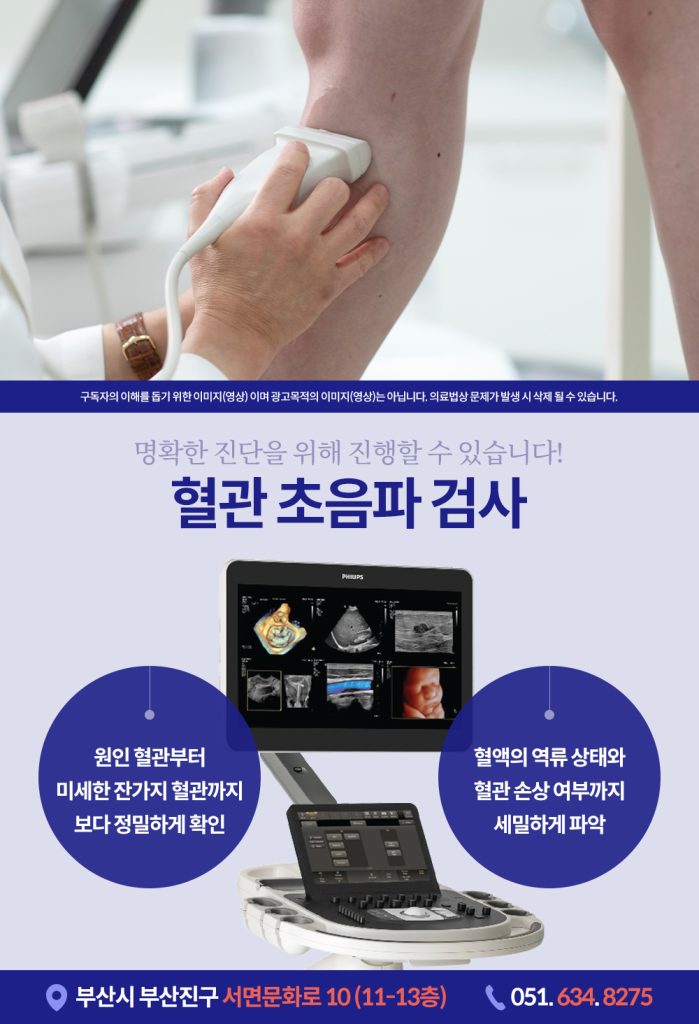 서면혈관초음파 고해상도 기기를 통해 다리 혈관 내부의 역류 상태를 실시간으로 검사하는 모습