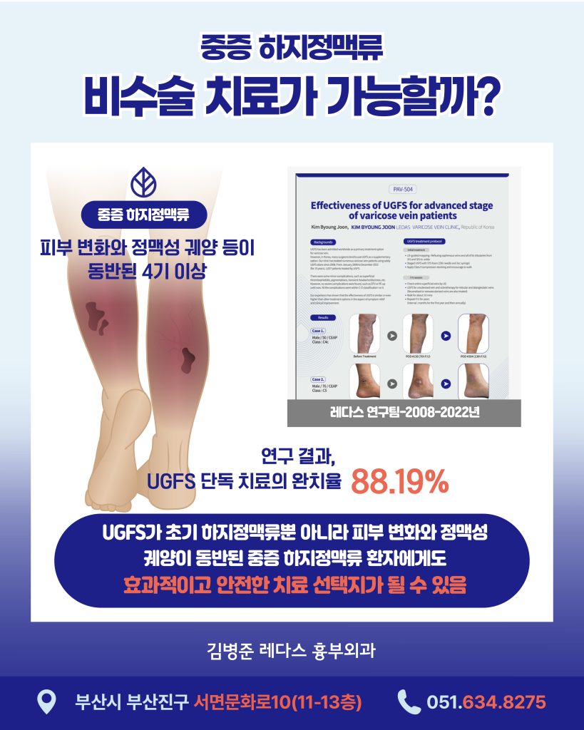 UGFS 단독 치료 완치율