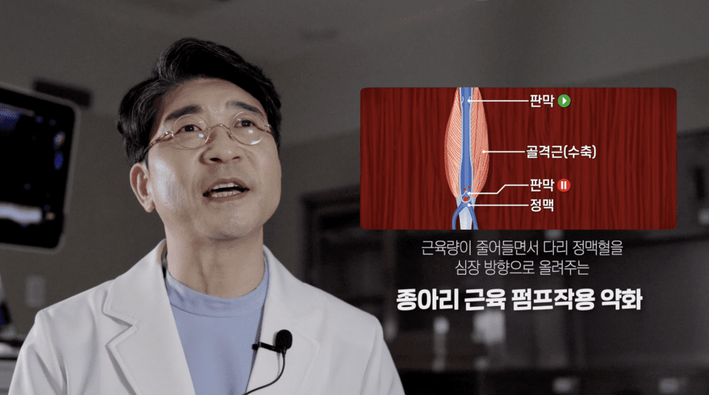 종아리 근육 펌프작용의 약화