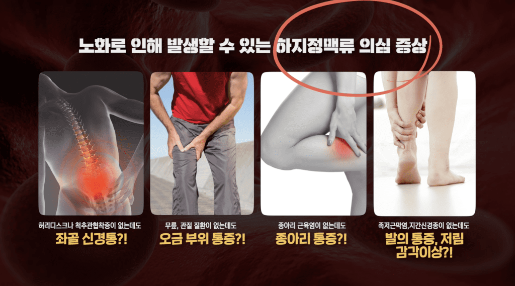 노화로 인해 발생할 수 있는 하지정맥류 의심 증상