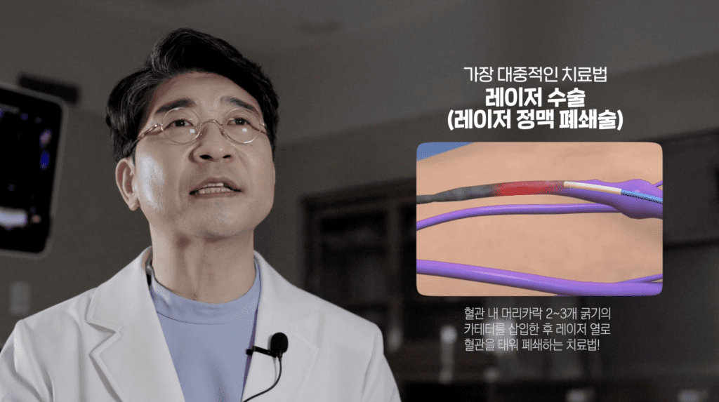 하지정맥류 레이저 수술