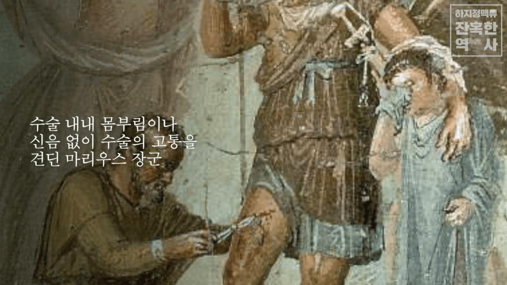 발거술 역사