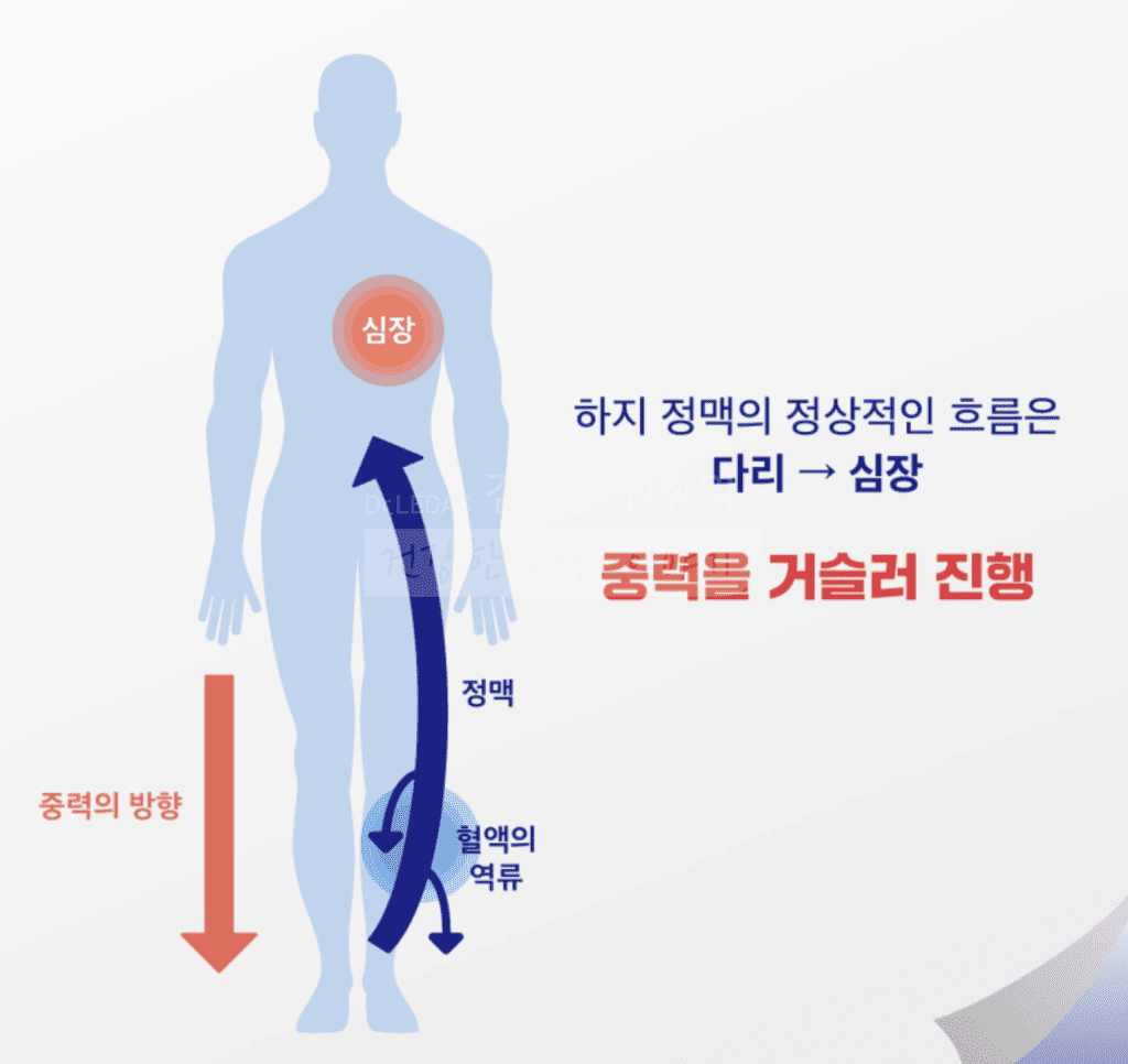 정맥 혈액 순환