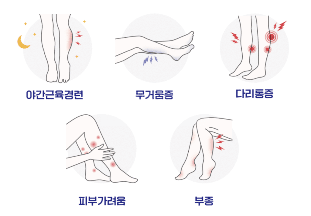 하지정맥류 증상