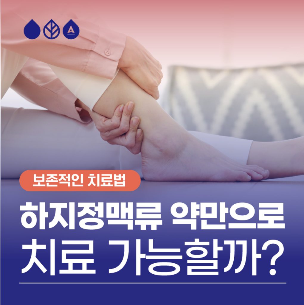 정맥순환개선제 보존적 치료법으로 하지정맥류 치료 가능할까?