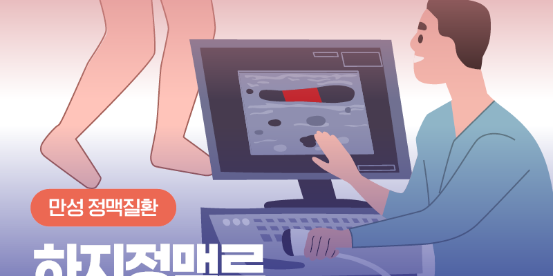 하지정맥류진단 기준은? 혈관 초음파 검사 결과