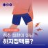 부산흉부외과 하지정맥류 오해와 진실 Varicose Veins: Myths vs. Facts