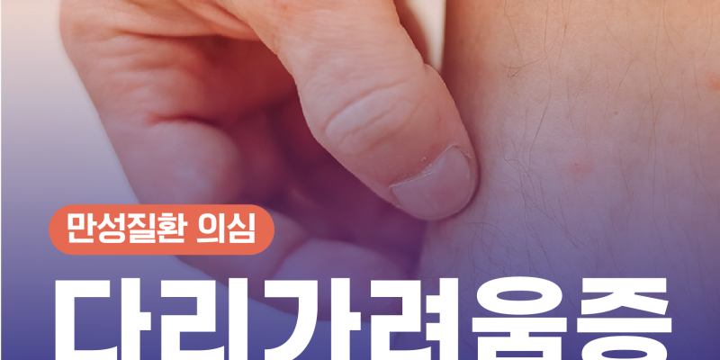 피부과 가도 안 낫는 발목·다리 가려움, 원인은 ‘하지정맥류’? | Itchy Legs & Varicose Veins