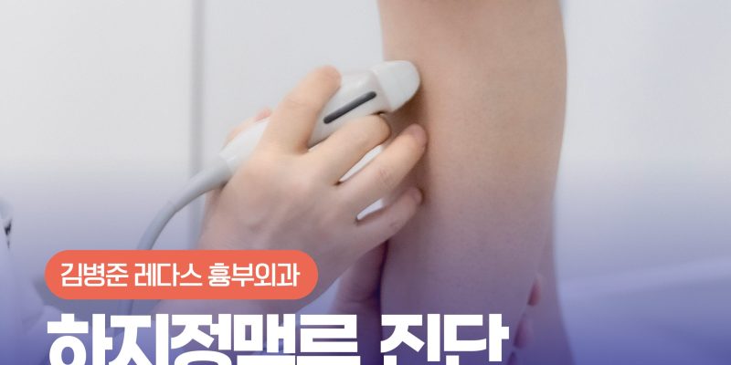 하지정맥류 진단 기준, 다리 실핏줄 겉모습만 보고 안심하면 안 되는 이유