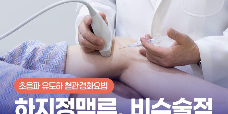 하지정맥류 비수술적 치료 중요한 이유, 초음파 유도하 혈관경화요법 완벽 활용법 Varicose Vein Care: Ultrasound Guided Foam Sclerotherapy