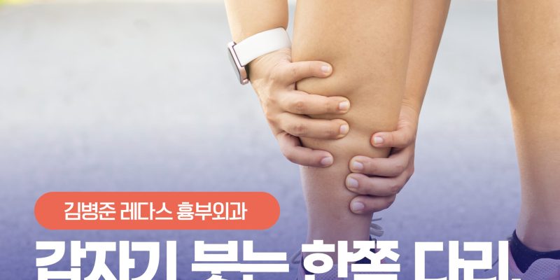 갑자기 붓는 한쪽 다리, 단순 부종일까 ‘혈전’ 때문일까? 심부정맥 혈전증 The Danger of Deep Vein Thrombosis (DVT)
