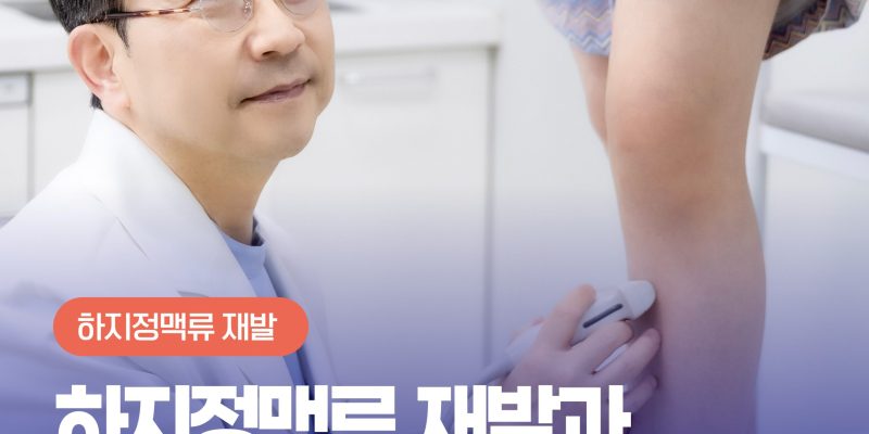 장기검진시스템 – 하지정맥류 재발이 걱정된다면