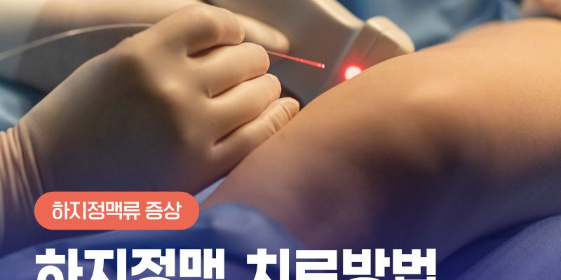 하지정맥치료방법 레이저부터 주사까지 종류별 특징