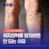 잦은 종아리통증과 다리저림, 일상 속 하지정맥류 예방관리법 | Varicose Veins Prevention 👣