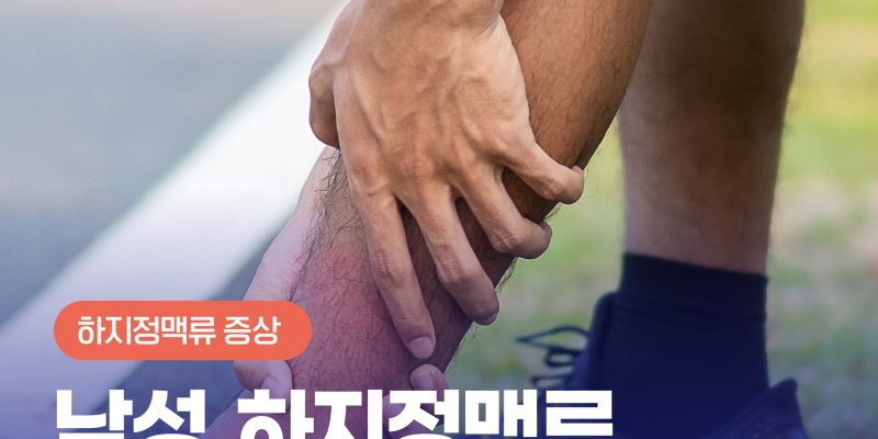 남성하지정맥류 증상 확인해보세요