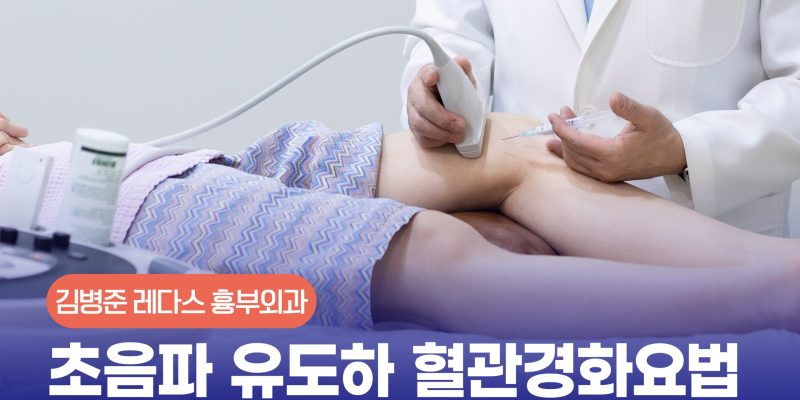 칼 안 대는 하지정맥류 비수술 치료! 혈관경화요법 주사로 정말 완치될까? | UGFS Sclerotherapy