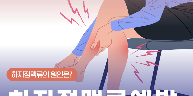 하지정맥류예방 운동 이렇게 하세요 prevention of varicose veins