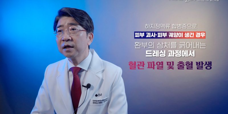 하지정맥류 혈관 터질 수도 있나요?