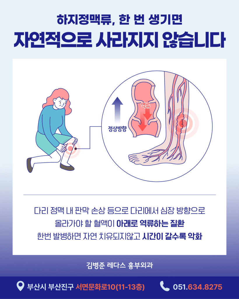 하지정맥류재발 은 2000년대 이후 하지정맥류 진단 장비 및 치료방법 발전, 그리고 치료 필요성이 널리 알려지면서 치료 환자가 늘어난 만큼 더불어 늘어나고 있습니다. 재발의 원인과 예방법에 대해 알아보도록 하겠습니다.