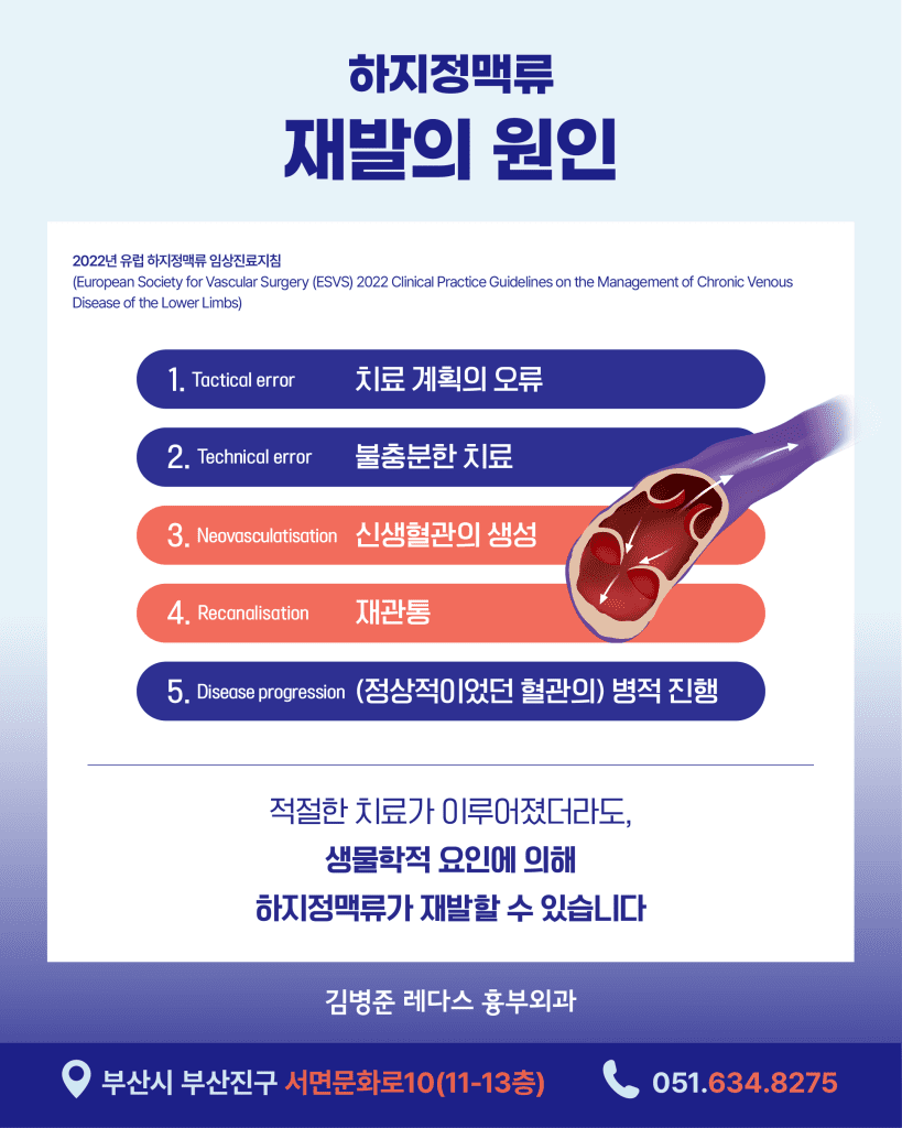 하지정맥류재발 은 2000년대 이후 하지정맥류 진단 장비 및 치료방법 발전, 그리고 치료 필요성이 널리 알려지면서 치료 환자가 늘어난 만큼 더불어 늘어나고 있습니다. 재발의 원인과 예방법에 대해 알아보도록 하겠습니다.
