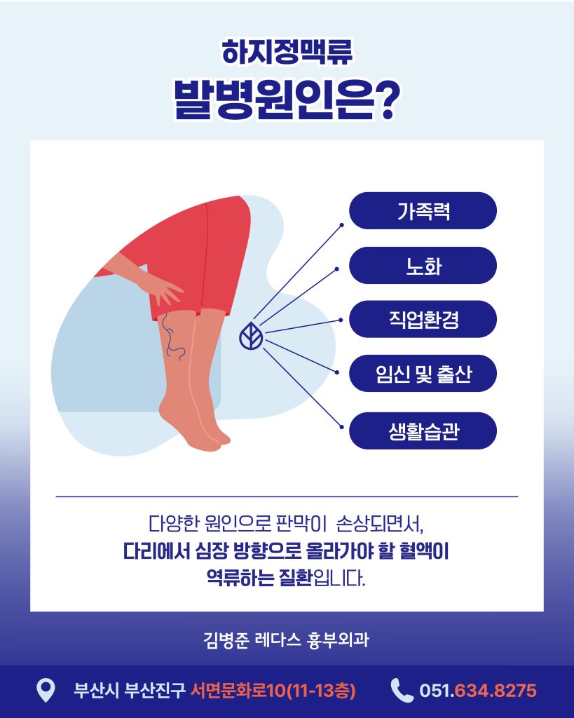 서면하지정맥류재발 하지정맥류는 성인 20~30%에서 발생하는 비교적 흔한 질환입니다.한 번 발병하면 자연적으로 회복되지 않고 시간이 지날수록 점점 심해지는 만성 진행성 질환이이므로, 중증이나 합병증으로 악화되기 전에 치료하는 것이 중요하죠.