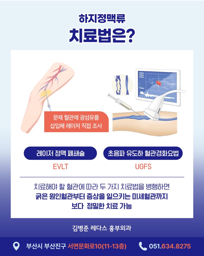 서면하지정맥류재발 하지정맥류는 성인 20~30%에서 발생하는 비교적 흔한 질환입니다.한 번 발병하면 자연적으로 회복되지 않고 시간이 지날수록 점점 심해지는 만성 진행성 질환이이므로, 중증이나 합병증으로 악화되기 전에 치료하는 것이 중요하죠.