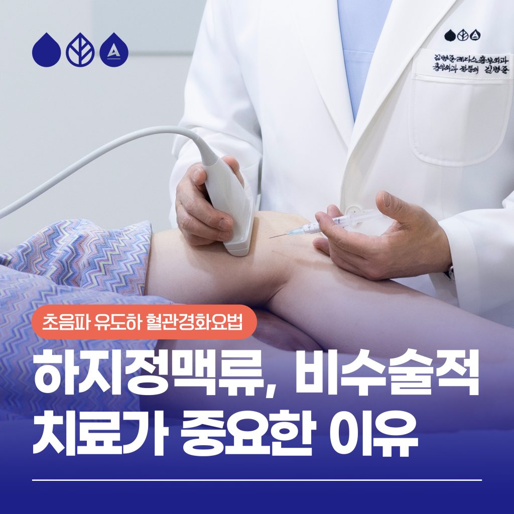 하지정맥류 비수술적 치료 초음파 유도하 혈관경화요법 중요성