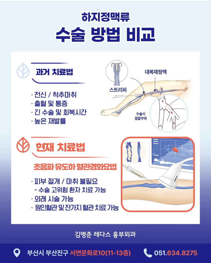 고해상도 초음파 화면으로 미세한 주사침을 이용해 시술하는 비수술 치료법 혈관경화요법