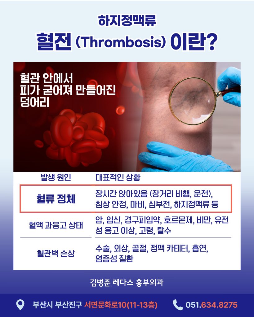 혈관 안에서 피가 굳어져 만들어진 덩어리