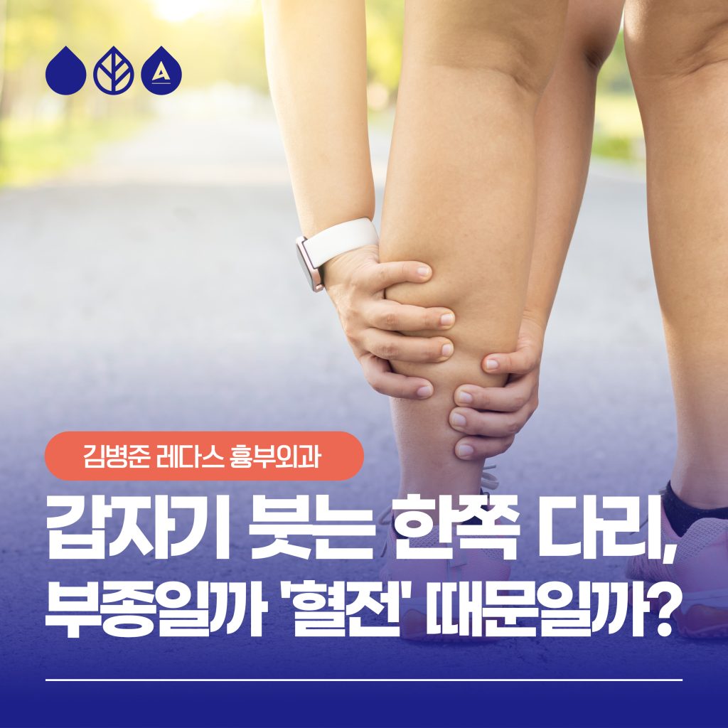 다리 붓기 혈전 심부정맥 혈전증