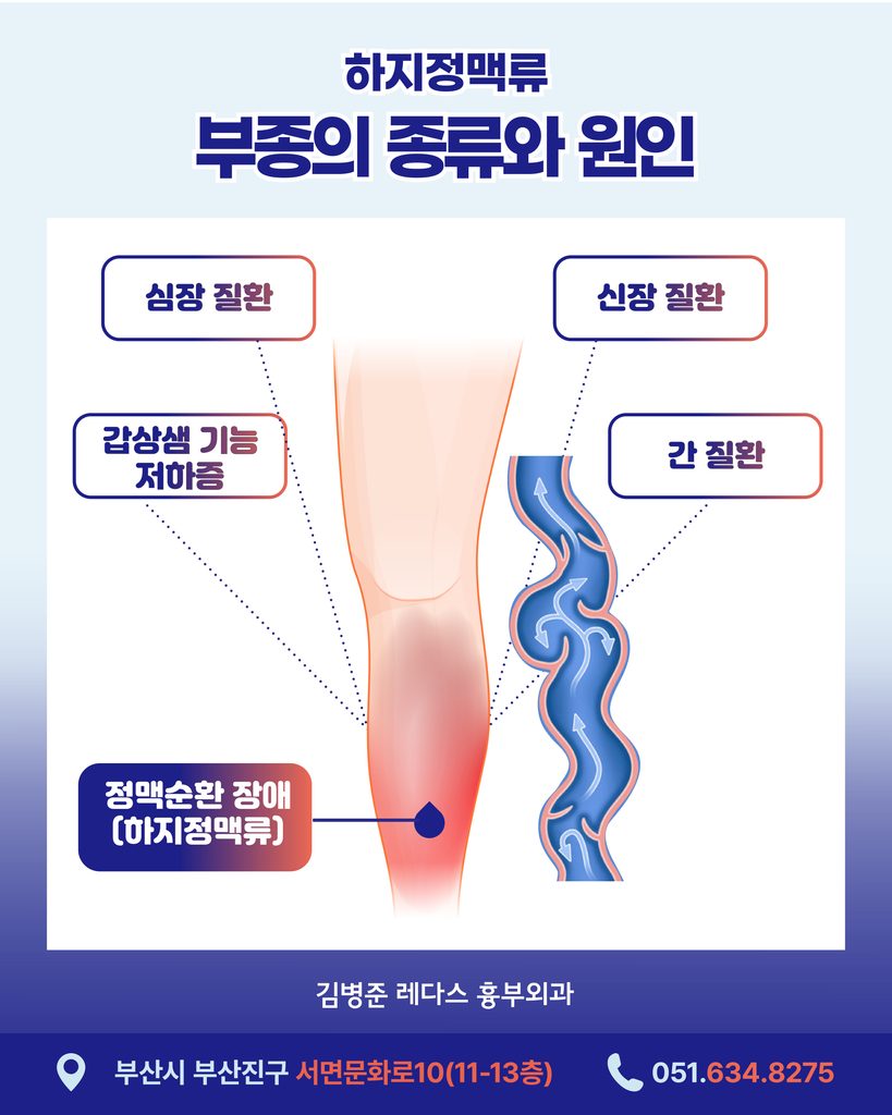 다리가 붓는 원리 정맥순환 장애