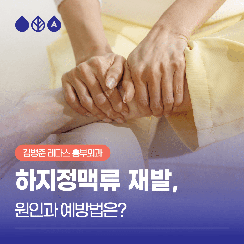 하지정맥류재발 은 2000년대 이후 하지정맥류 진단 장비 및 치료방법 발전, 그리고 치료 필요성이 널리 알려지면서 치료 환자가 늘어난 만큼 더불어 늘어나고 있습니다. 재발의 원인과 예방법에 대해 알아보도록 하겠습니다.