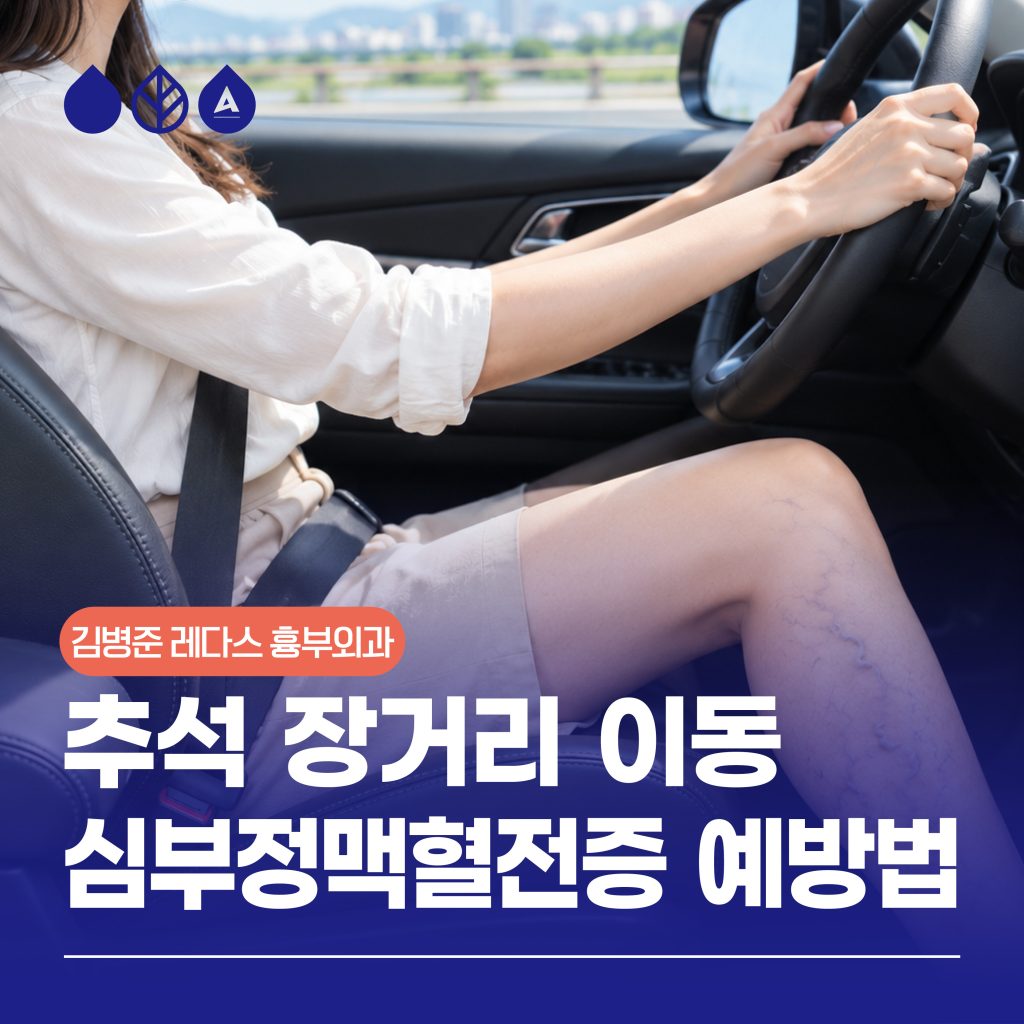 심부정맥혈전증, 추석 장거리 이동, 귀성길 다리 붓기