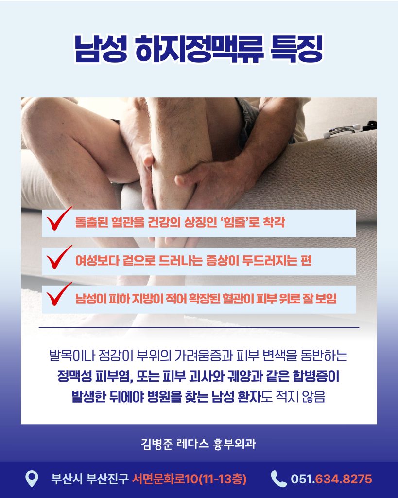 남성하지정맥류 여성보다 겉으로 드러나는 증상이 두드러지는 편입니다. 이는 남성이 상대적으로 피하 지방이 적어 확장된 혈관이 피부 위로 잘 보이기 때문인데요. ‘힘줄’로 착각해 치료 시기를 놓치는 경우가 많습니다.