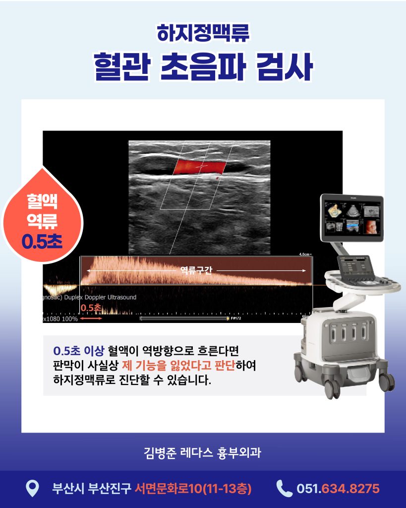 남성하지정맥류 여성보다 겉으로 드러나는 증상이 두드러지는 편입니다. 이는 남성이 상대적으로 피하 지방이 적어 확장된 혈관이 피부 위로 잘 보이기 때문인데요. ‘힘줄’로 착각해 치료 시기를 놓치는 경우가 많습니다.