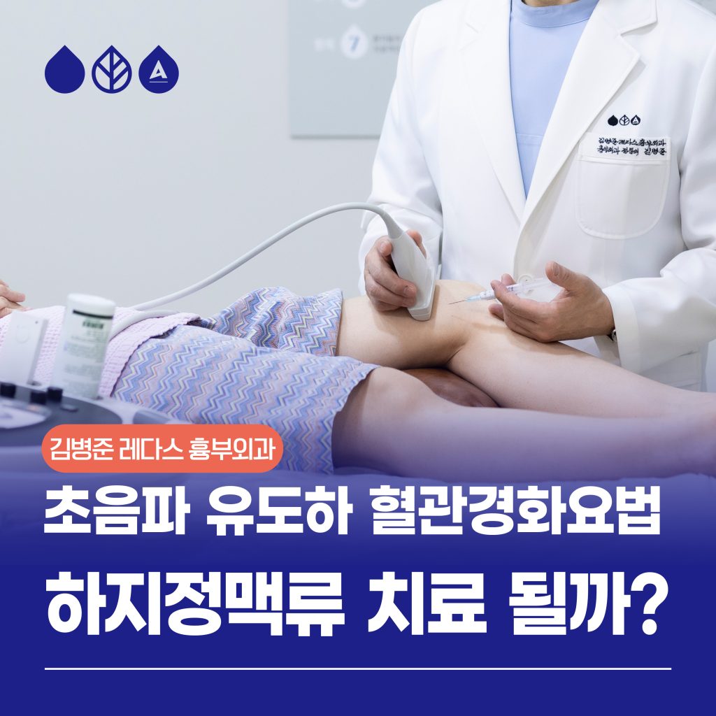 하지정맥류 비수술